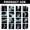 16Pcs Realistic Broken Bones X-Ray (9.8"x9.8") Skeleton X-Rays Human Skeleton