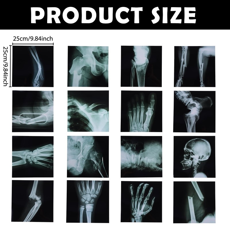 16Pcs Realistic Broken Bones X-Ray (9.8"x9.8") Skeleton X-Rays Human Skeleton