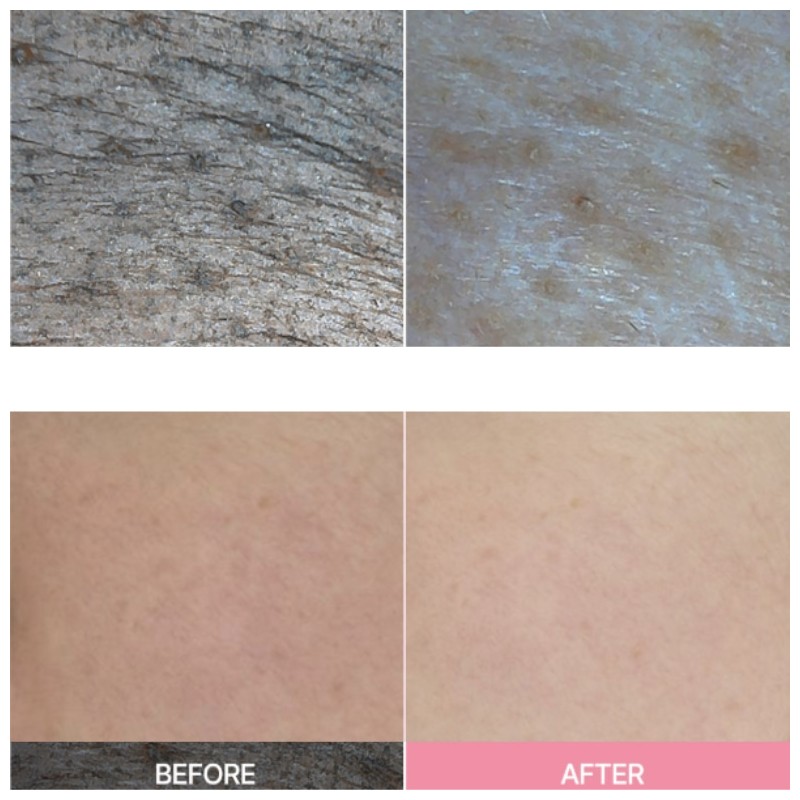 APRILSKIN TXA Niacinamide 99 Deep Cleanser 120g