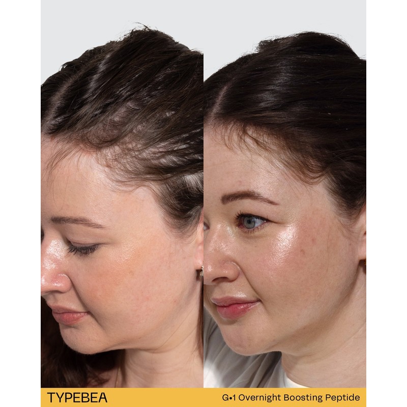 TYPEBEA G1 Overnight Boosting Peptide Serum 10ml