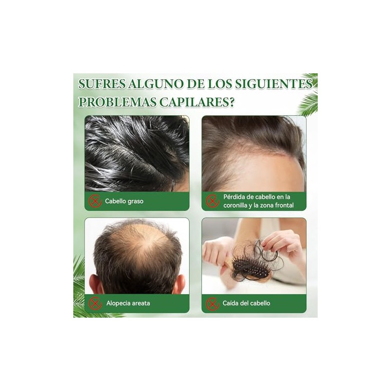 1PCS Shampoo Romero,Champú de Aceite Battana de 300 ml para