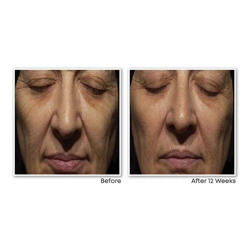 Roc Retinol Correxion Kit Cremas Día Y Noche Antiarrugas