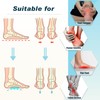 TOMUST Arch Support Bands (Pair) for Plantar Fasciitis Relief –