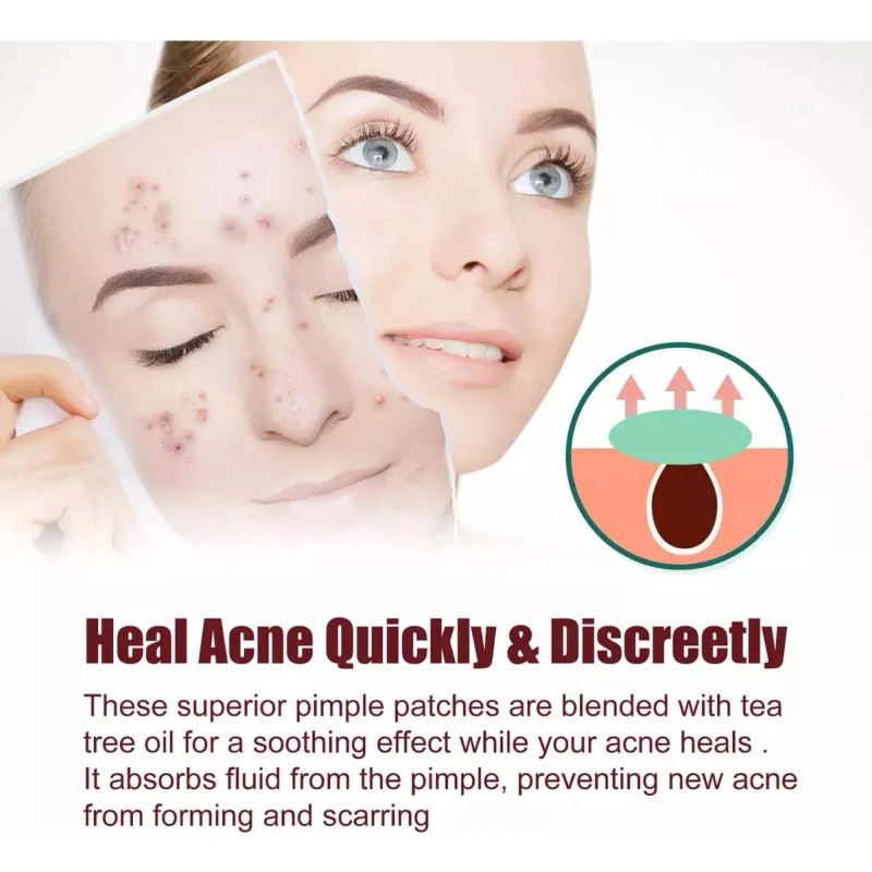 200pzs Mascarillas Estrella Acne