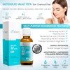 Acido Glicolico 70% 30ml Peeling Químico