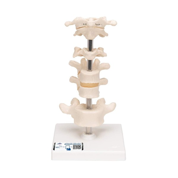 1 ring / axis, 1 cervical spine, 2 thoracic spine, 1 lumbar spine model - 6 spine models - 3B Scientific