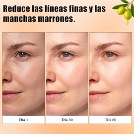 2PCS Barra de ácido Kójico, acido kojico para manchas, Jabón de ácido kójico puede eliminar los puntos negros, jabones iluminadores de limón para atenuar las manchas oscuras