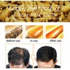 Champú Con Jengibre Para El Crecimiento Del Cabello, Champú Orgánico