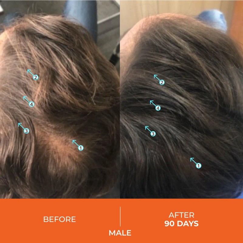 Shampoo Ds Laboratories Revita Para Engrosar El Cabello Para