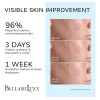 Tratamiento Bellamiluxx Para El Acné Quístico Facial: Crema