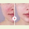 pow Pau Skin Solution SOS Mask 10 sheets, 4 pieces