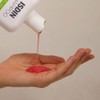 ISDIN Nutradeica Shampoo Anticaspa grasa, Reduce la Descamación, el Picor