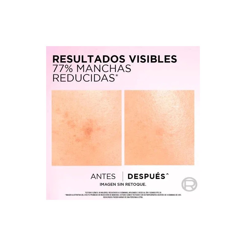 Sérum L'oréal Paris Anti-manchas Con Ácido Glicólico 30ml Todo Tipo