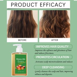 Batana Oil Shampoo,Organic Batana Oil for Healthy Hair,Anti Hair Loss, Eliminates Split Ends,Repairs Damaged Hair for Denser Fuller Healthier Hair for All Hair Types,100ML