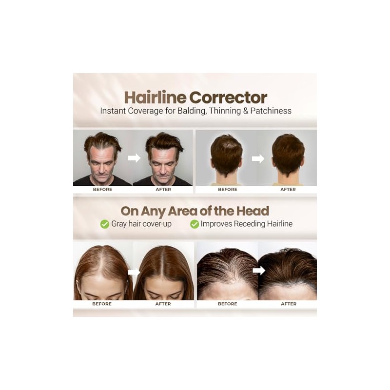 Herbishh Hair Root Touch-Up Powder For Women & Men Medium