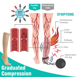 Bropite Calcetines de compresión de punta abierta para hombres y mujeres, 2 pares de calcetines de compresión médica de circulación sin dedos de 15 a 20 mmhg, Beige, Small-Medium