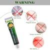 Psoriasis Cream, Care Cream, Limplify Psoriasis Cream, Psoriasis Cream, Psoriasis