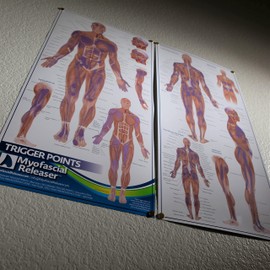 Dos mapas de anatomía de punto de activación, póster de pared de oficina médica para referencia por terapeutas de masaje, fisioterapeutas, quiroprácticos, entrenadores, punto de presión y tabla de dolor referido