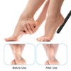 MBAIYO Foot File, Pumice Stone Exfoliating Pedicure Rasp Foot Scrubber