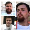 Bálsamo Para Crecimiento De Barba, Cierra Huecos Y Alopecias Cítrica