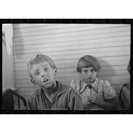 HistoricalFindings Photo: Son of Olaf Fugelburg,Farmer of Williams County,North Dakota,ND,Weeping Eczema