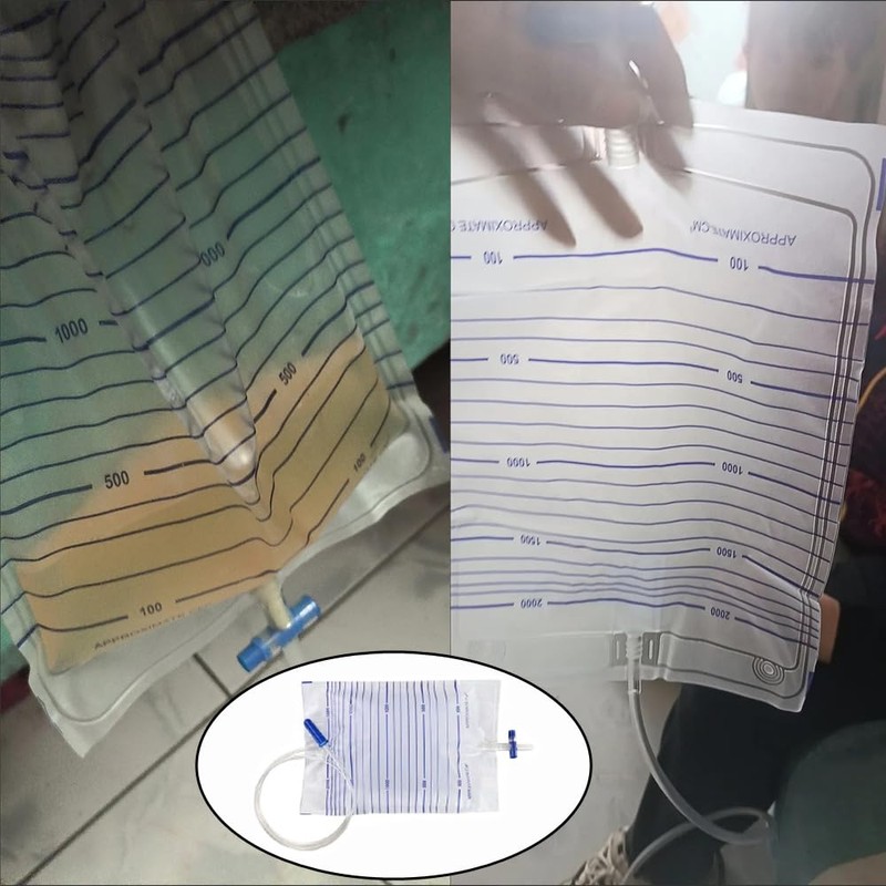 DeaHea 5 Pack Urinary Drainage Bag 2000ML Urine Bag with