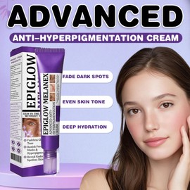 Hyperpigmentation Treatment Cream,Anti Pigmentation Removal Cream，Dark Spot Remover for Face,Face Cream for Melasma Hyperpigmentation, Spot Treatment for All Skin Type