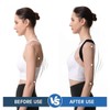 SUNDPIK 남성을 위한 SUNDPIK 1PCS 좋습니다 상부 조절 교정기 스트레이트너