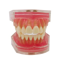 Dental Model Dental Explanation Model Dental Implant Dental Model Upper and Lower Jaw Model for Research and Treatment Instructions Removable