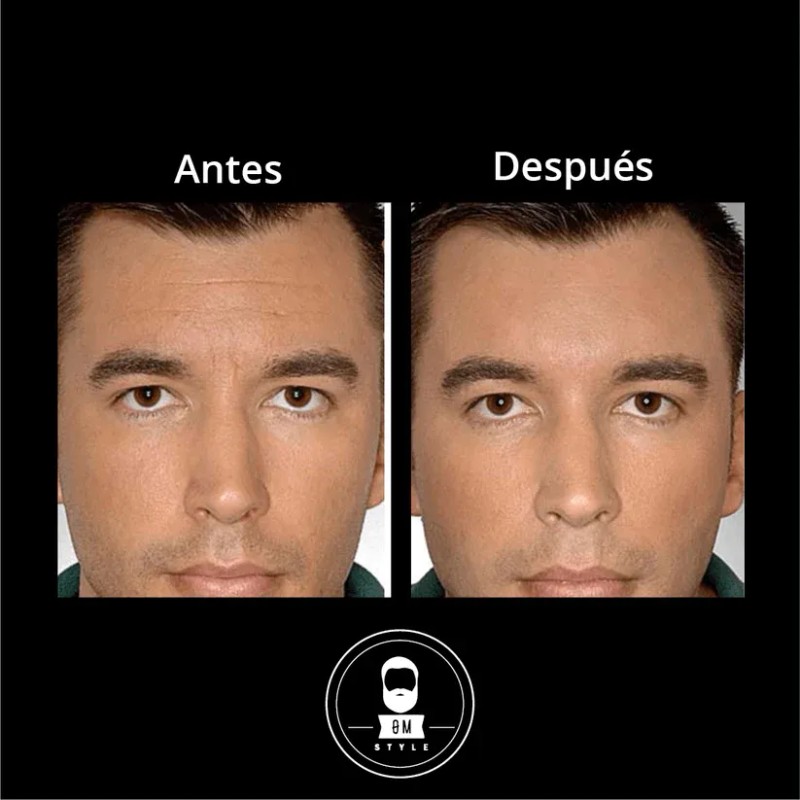 Kit Anti Ojeras Y Arrugas Roll On + Serum Antiedad