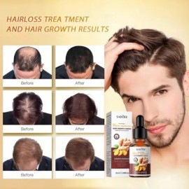 Aceite Serum Para Cabello De Jengibre Crecimiento Anti Caida