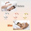 Anti Snoring Ring, Stop Snoring Aids for Men Women, Sleep