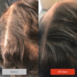 Champú REVITA (925 ml) de DS Laboratories para adelgazar el cabello