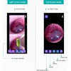 ScopeAround Wireless Otoscope Ear Camera with Dual View, 3.9Mm 720PHD