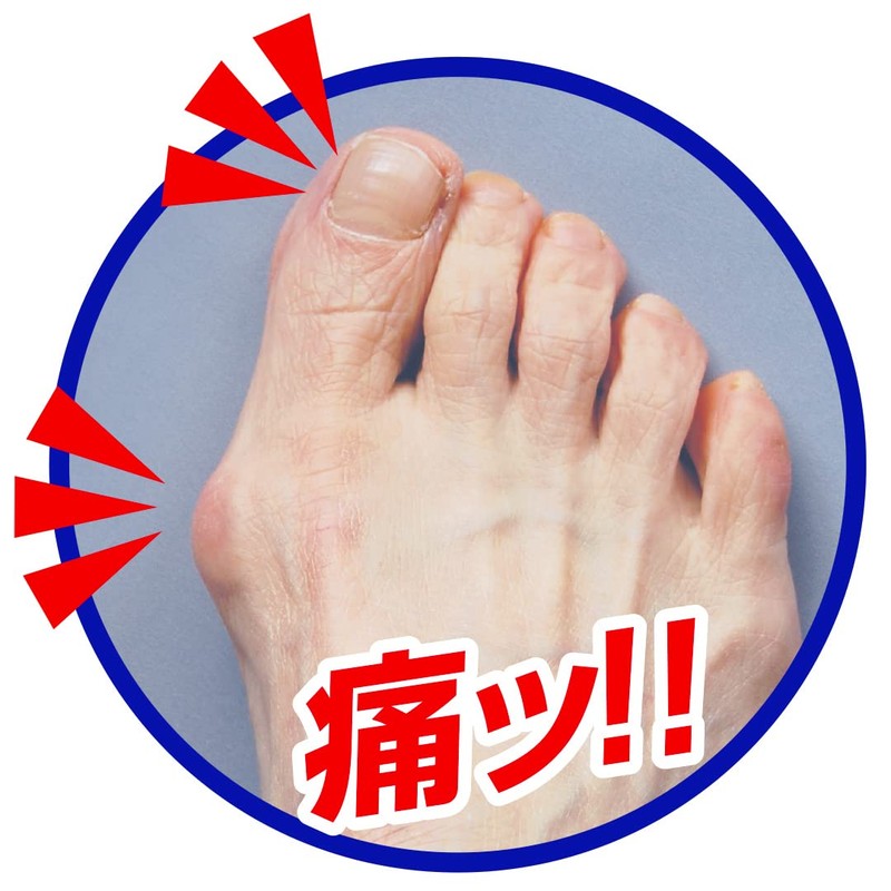 Cyplus Soft Type Gel Material, Squishy Material, Finger Pad, Spreading