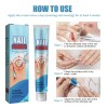 Tt/ Crema Fungicida Para Hongos En Uñas Y Piel De