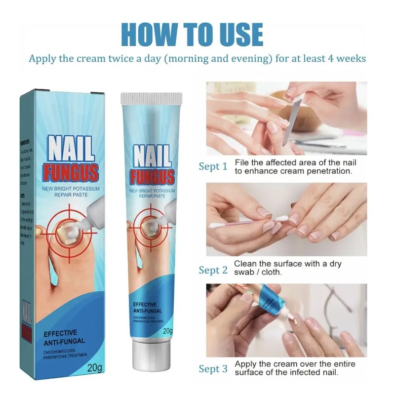 Tt/ Crema Fungicida Para Hongos En Uñas Y Piel De