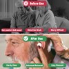 XIHIRCD 9pcs Hearing Amplifier Domes and Cleaning Kit for Audien