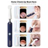 BEBIRD Earsight Plus Ear Wax Removal Tool Camera with HD
