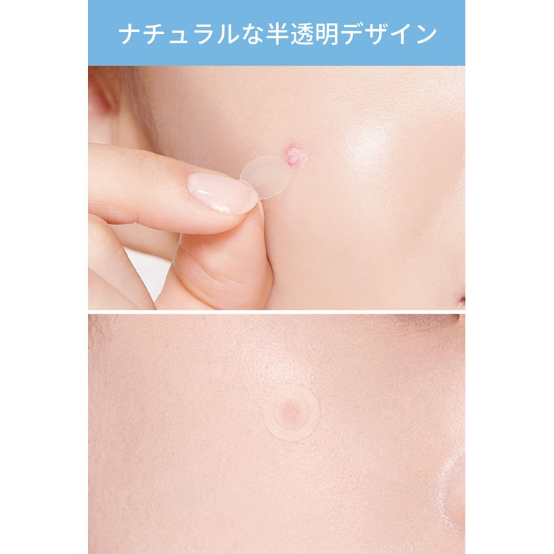 Patch, Point Patch, Day and Night, Unisex, Invisible, Won't Peel