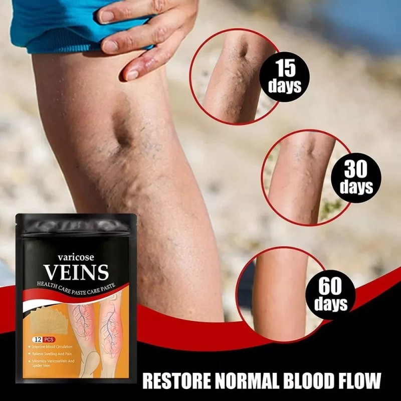 72 Parche Muslos Piernas Aliviar Las Venas Varicosas