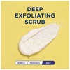 St. Ives Acne Control Face Scrub, Apricot, 6 oz