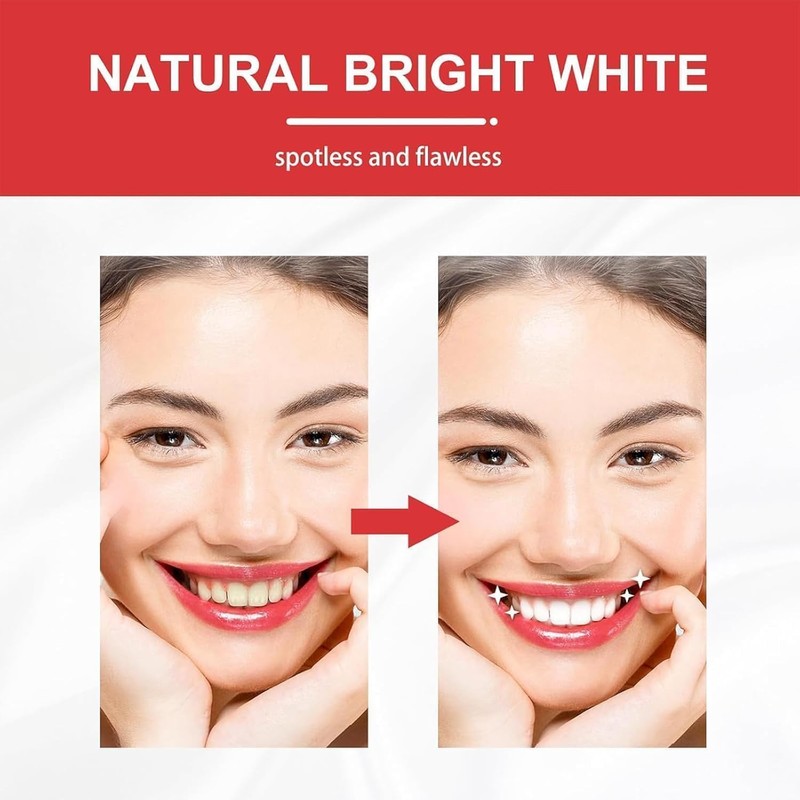 Sp 10 Toothpaste, Sp 10 Probiotic Toothpaste(1Pcs)