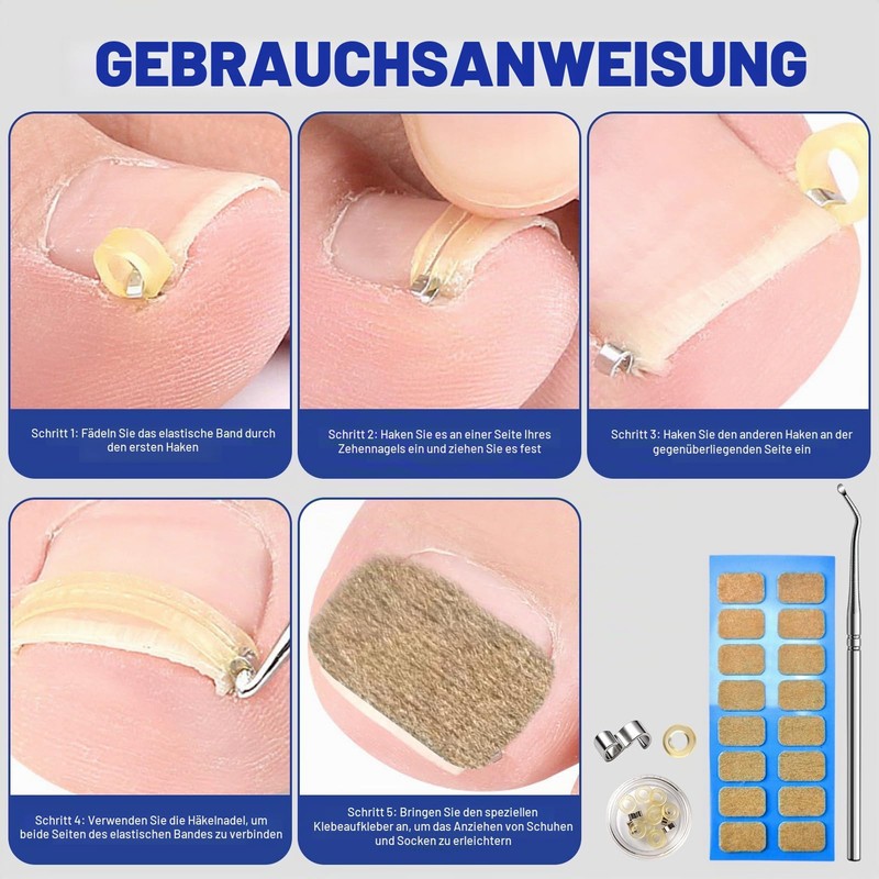 Ingrown Toenails Tool Set, Ingrown Toenails Correction