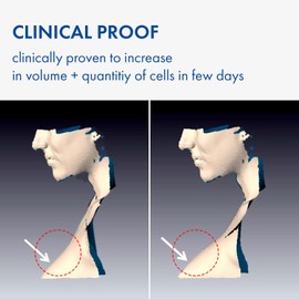 TOSOWOONG TOSOWOONG Volufiline Serum, 100% France Sederma Volufiline Concentrate for Plumping, Skin firming, Boost and Glass skin, glow Skincare for Face, lip and body, 11ml 0.37 fl. oz.