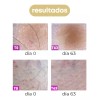 Videlca Locion Inhibidora De Vello Videlca 50ml - Post Depilación