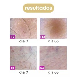 Videlca Locion Inhibidora De Vello Videlca 50ml - Post Depilación