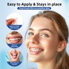 RAZOKO Orthodontic Wax for Braces Wax Dots 90 Individual Hygienic