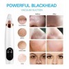 FanShen Scrubber, Ems, Eliminación Del Acné, Facial 3 Kit