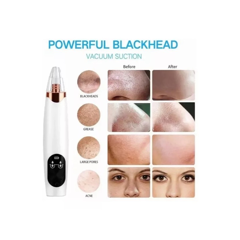 FanShen Scrubber, Ems, Eliminación Del Acné, Facial 3 Kit